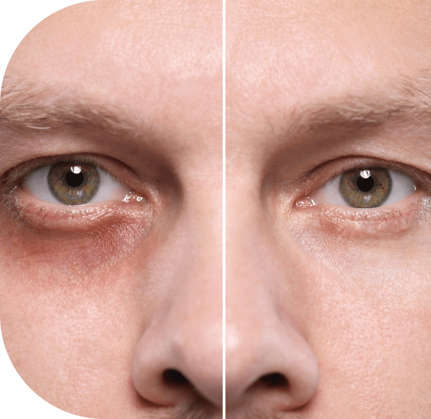 | Icelift shutterstock 2442682171