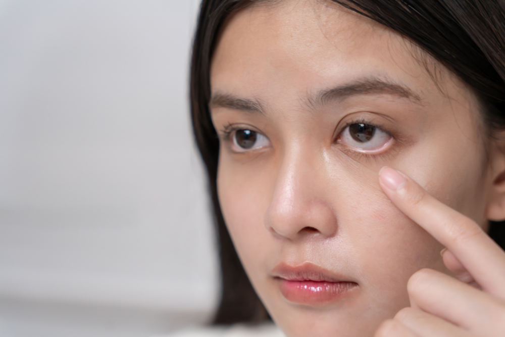 How to Get Rid of Puffy Eyes Fast Simple Fixes That Actually Work1 | Icelift Close up of a woman touching under her eye with her finger as if applying skincare or checking her skin